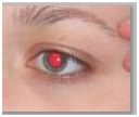 Photo des yeux rouge