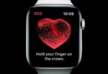 ECG d'Apple Watch