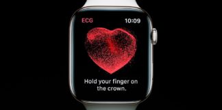 ECG d'Apple Watch