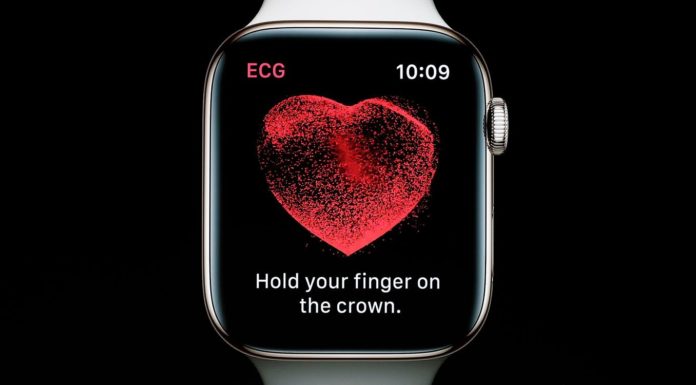 ECG d'Apple Watch